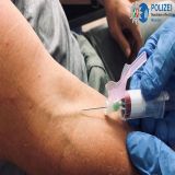 Blutprobe